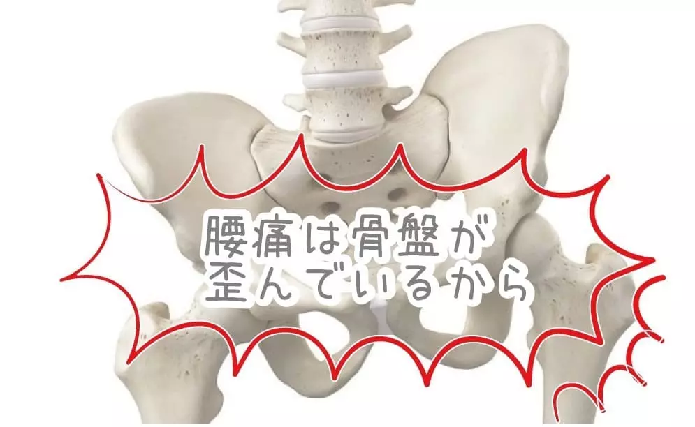 骨盤が歪んでいるから